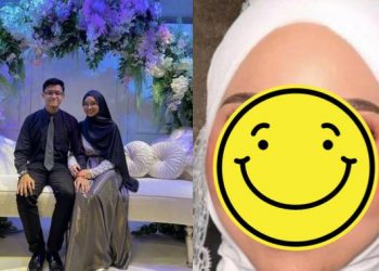Berkat Makeup, Penampilan Pengantin dengan Luka di Wajah Ini Bikin Pangling