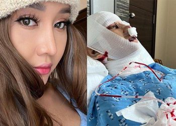 Lucinta Luna Buka Topeng Wajah Barunya, Netizen Kecewa