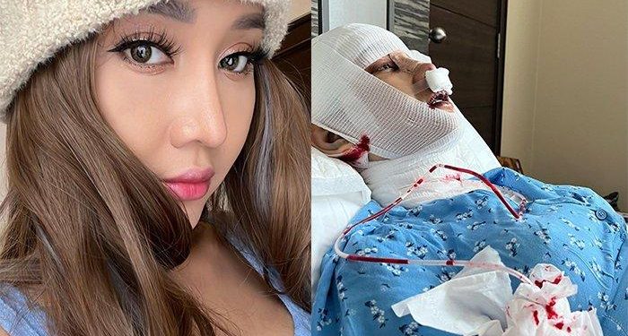 Lucinta Luna Buka Topeng Wajah Barunya, Netizen Kecewa