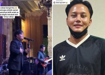 Penampilan Rizky Febian Setelah Operasi Hidung