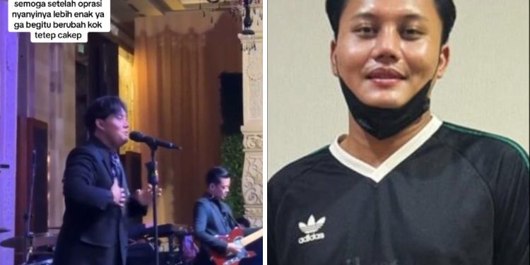 Penampilan Rizky Febian Setelah Operasi Hidung